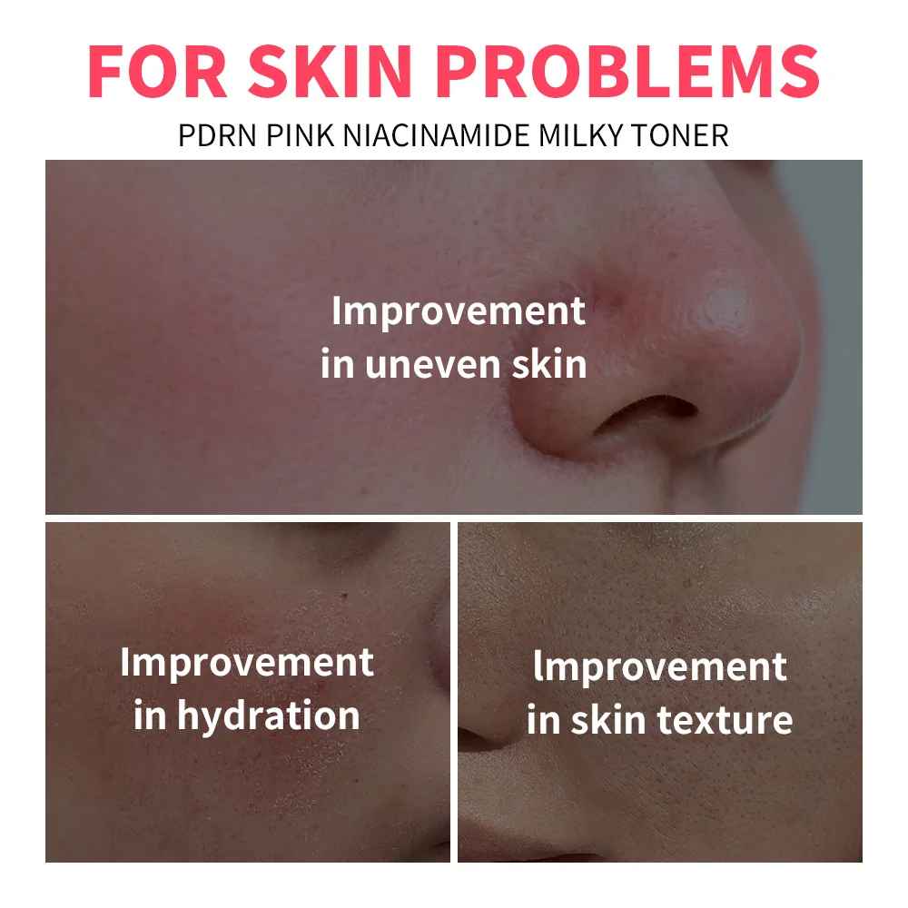 Pink Niacinamide Milky Toner – Hydrating & Even Skin Tone Daily Care-Toner-Blushia