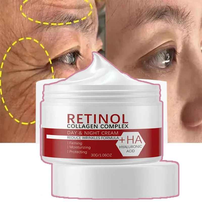 Retinol Whitening Cream for Face & Body – Collagen & Hyaluronic Acid Dark Spot Corrector-Whitening Cream-Blushia