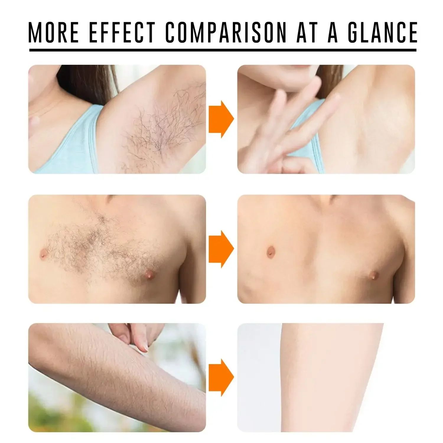 Sakura Hair Removal Cream Fast Painless Hair Growth Inhibitor Arm Armpit Legs Intimate Areas Permanent Depilatory for Men Woman-Shaving-Blushia