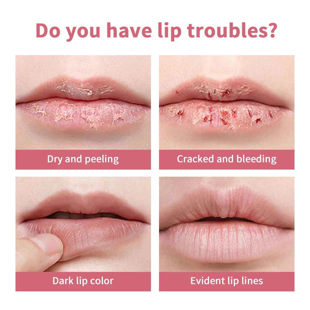 Honey Tinted Lip Balm – Pink Moisturising Lip Care & Dark Lip Repair-Tinted Lip Balm-Blushia