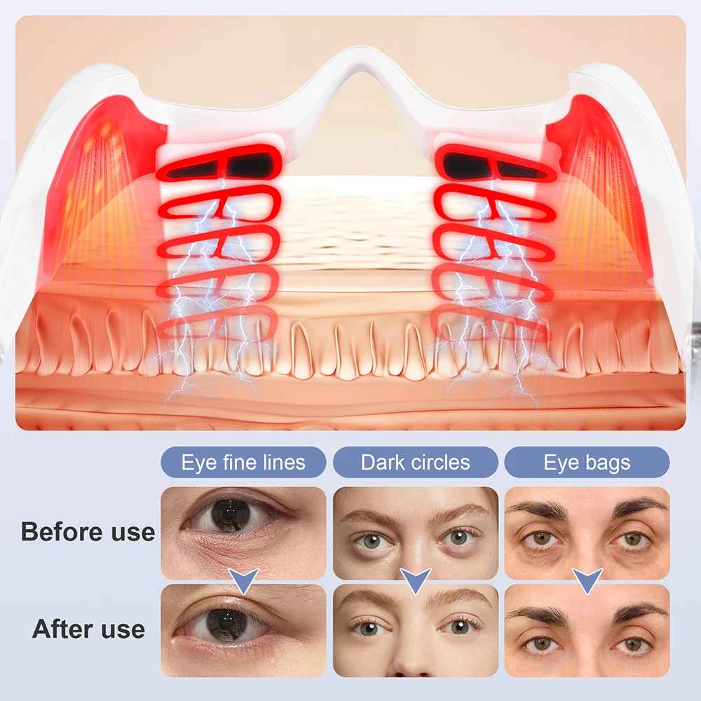 Electric Under-Eye Massager Glasses with Red Light – Relieve Eye Fatigue & Puffiness-Eye Care Accessories-Blushia