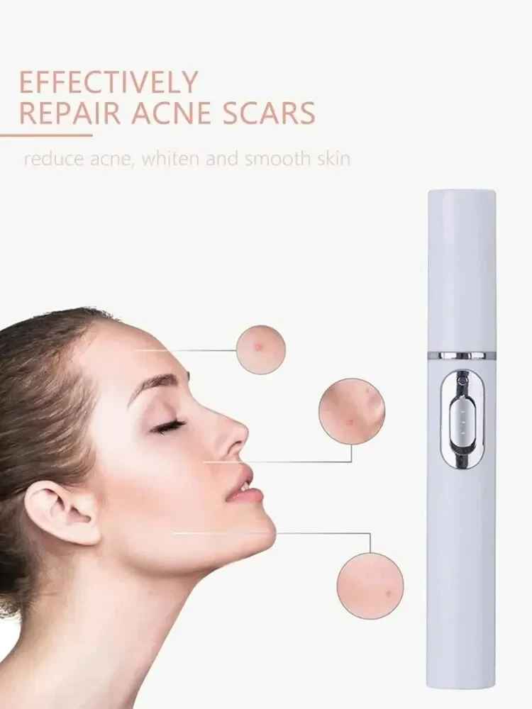 Electric Eye Massager with Blue Light Therapy – Reduce Puffiness & Dark Circles for Smoother, Brighter Eyes-Eye Massager Device-Blushia