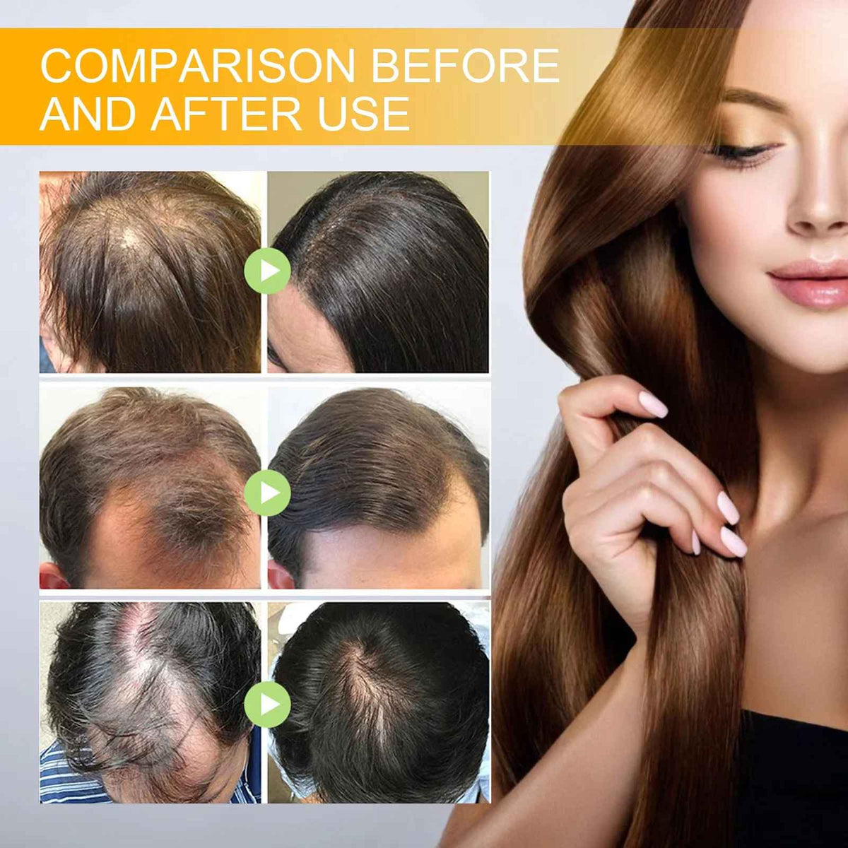 Biotin Hair Growth Serum Spray – Anti-Hair Loss Scalp & Beard Treatment