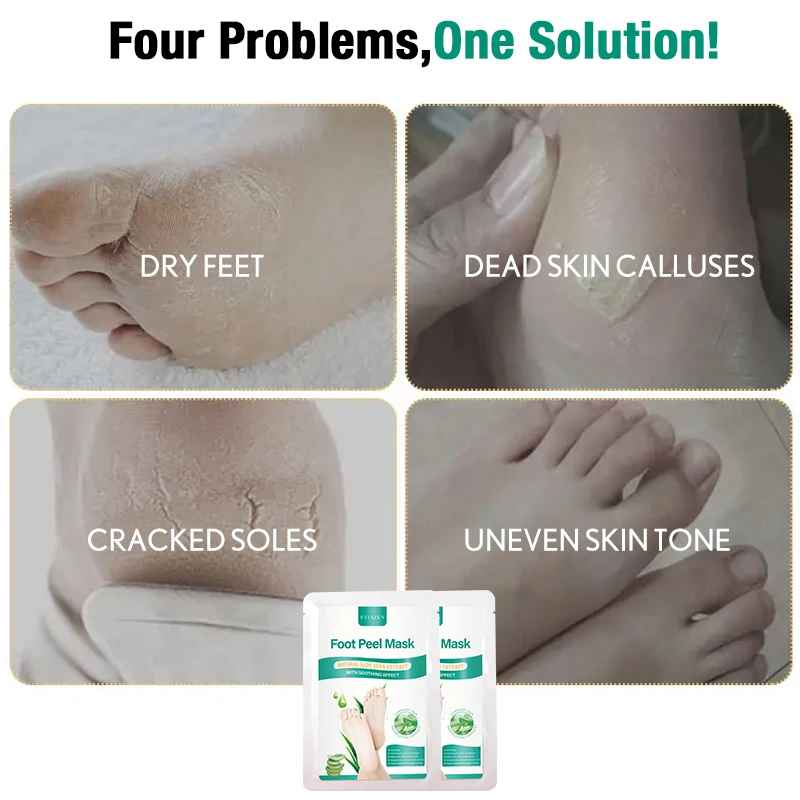 Aloe Foot Peel Mask – Soothing, Brightening & Softening for Dry Cracked Feet-Foot Mask-Blushia