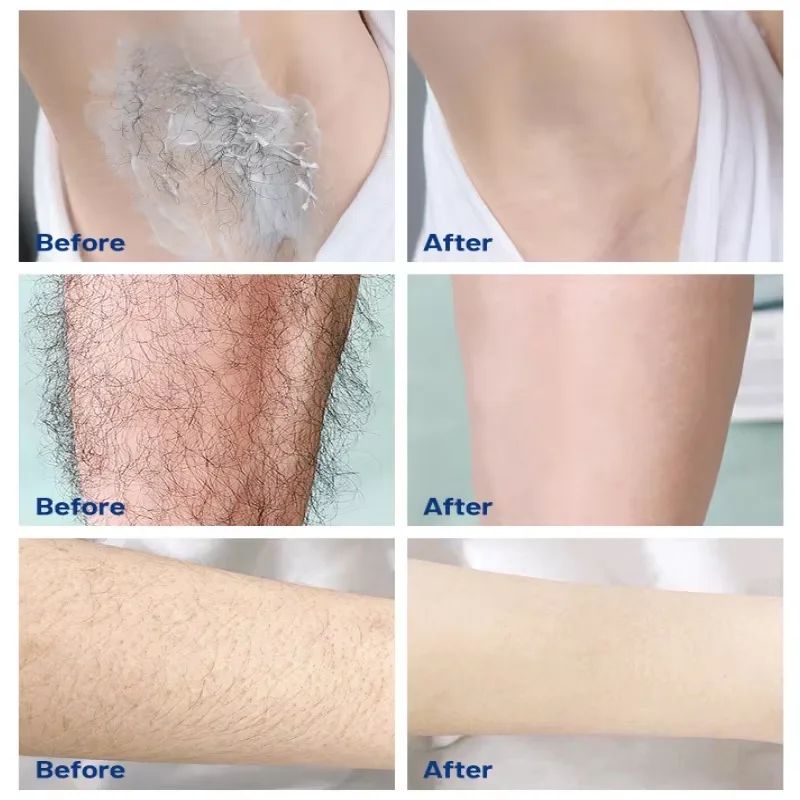 Sakura Hair Removal Cream Fast Painless Hair Growth Inhibitor Arm Armpit Legs Intimate Areas Permanent Depilatory for Men Woman-Shaving-Blushia