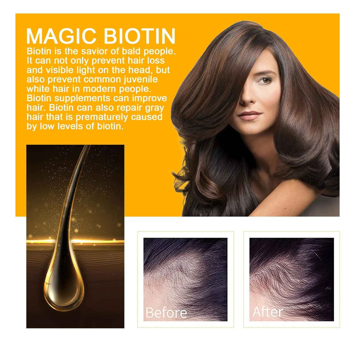 Biotin Hair Growth Serum Spray – Anti-Hair Loss Scalp & Beard Treatment